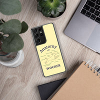 Wocker Phone Case